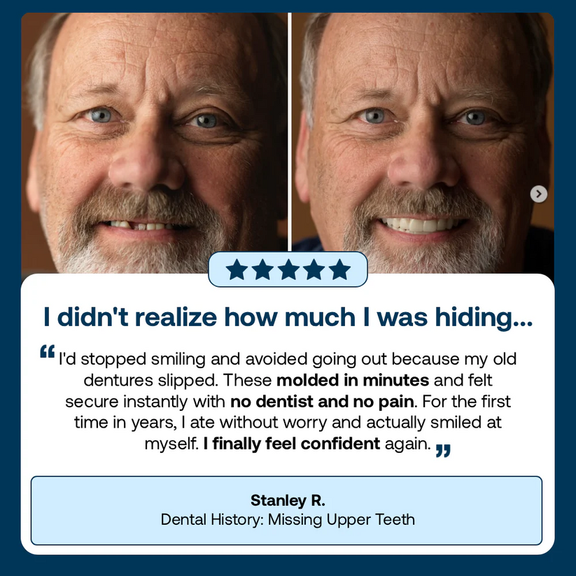 👑2026 Hot Sale Ends Today: 70% OFF! Custom Custom-Fit Full Functional Dentures Make you more confident – Made in the USA
