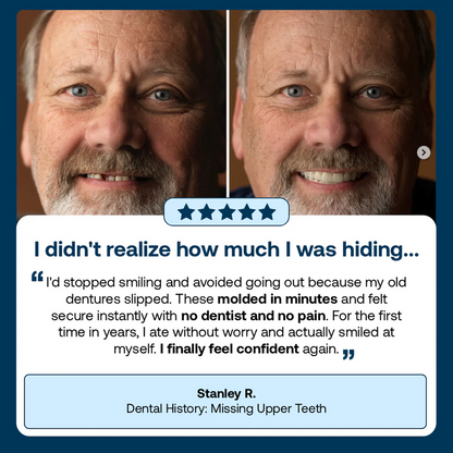 👑2026 Hot Sale Ends Today: 70% OFF! Custom Custom-Fit Full Functional Dentures Make you more confident – Made in the USA