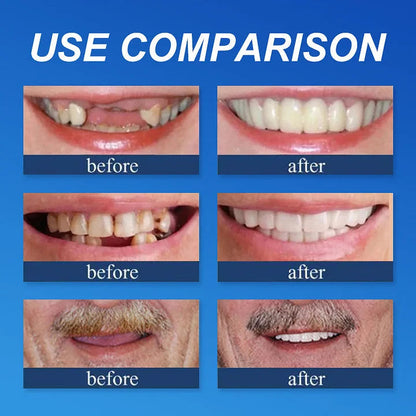 👑2026 Hot Sale Ends Today: 70% OFF! Custom Custom-Fit Full Functional Dentures Make you more confident – Made in the USA