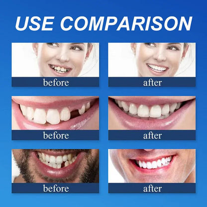 👑2026 Hot Sale Ends Today: 70% OFF! Custom Custom-Fit Full Functional Dentures Make you more confident – Made in the USA